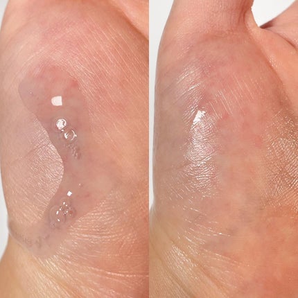 ゼロ毛穴パッド 2.0/MEDICUBE/トナーパッドを使ったクチコミ(3枚目)