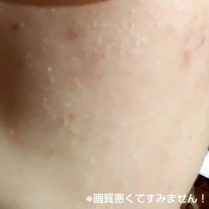 おうちdeエステ 肌をなめらかにする マッサージ洗顔ジェル/ビオレ/その他洗顔料を使ったクチコミ(2枚目)