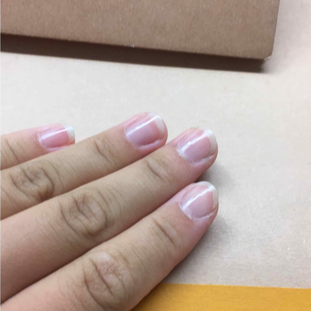 エテュセ クイックケアコート/ettusais/ネイルオイル・トリートメントを使ったクチコミ（2枚目）