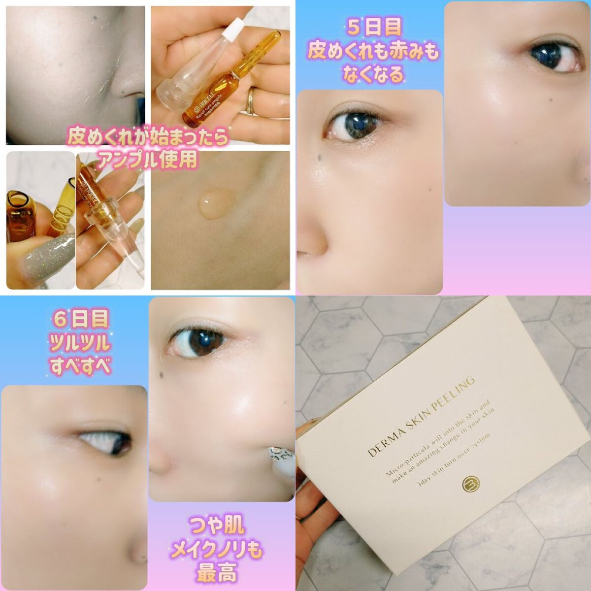 ダーマスキンピーリング/BQCELL/その他キットセットを使ったクチコミ(3枚目)