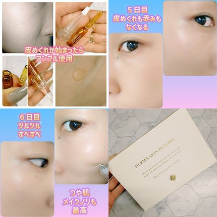 ダーマスキンピーリング/BQCELL/その他キットセットを使ったクチコミ(3枚目)