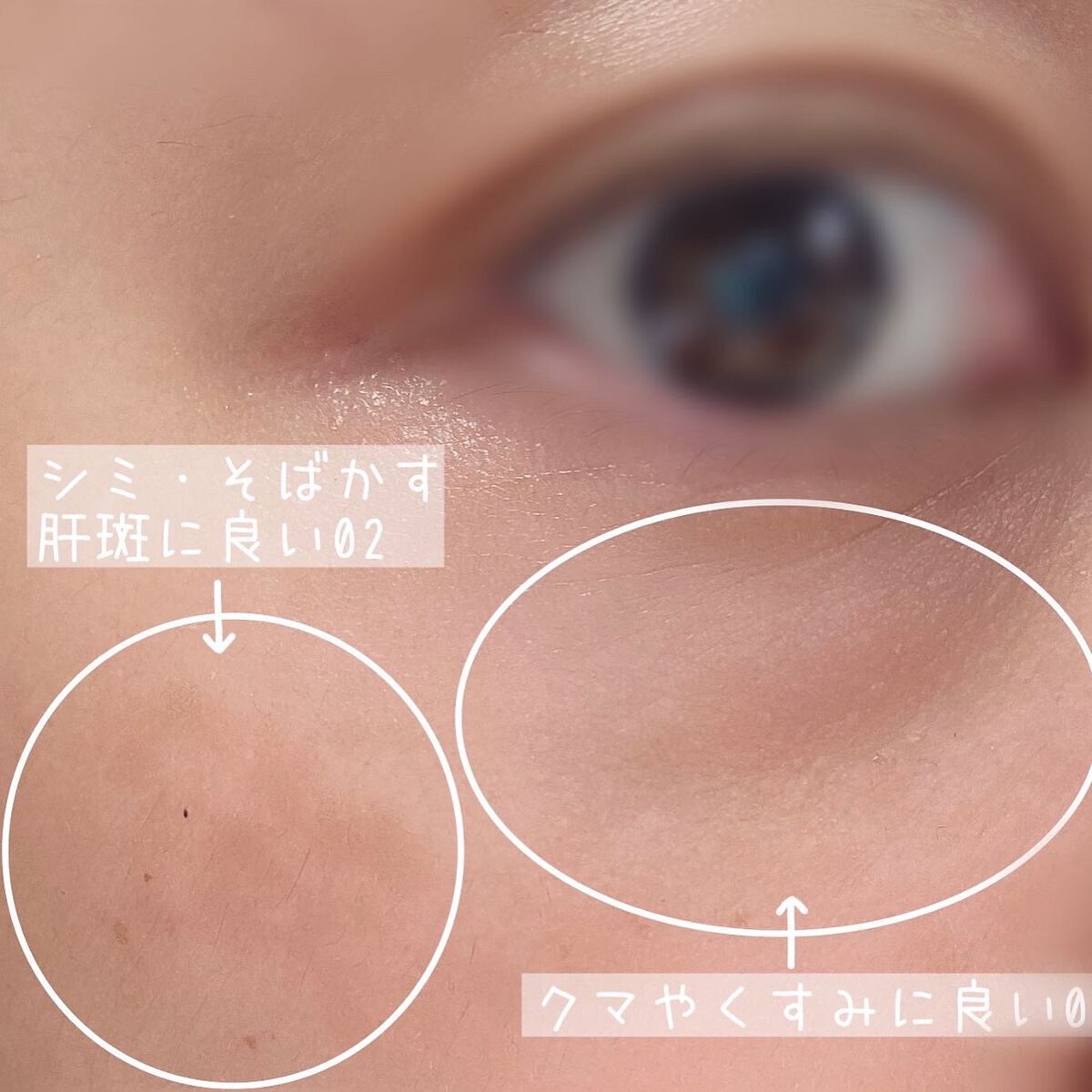 デザイニング コンシーラー/ブリリアージュ/リキッドコンシーラーを使ったクチコミ(4枚目)