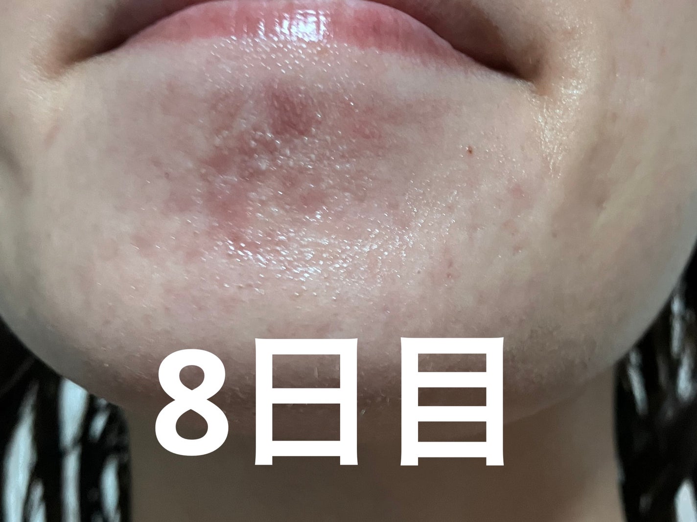 ソフティモ 泡洗顔(セラミド)/ソフティモ/泡洗顔を使ったクチコミ(8枚目)