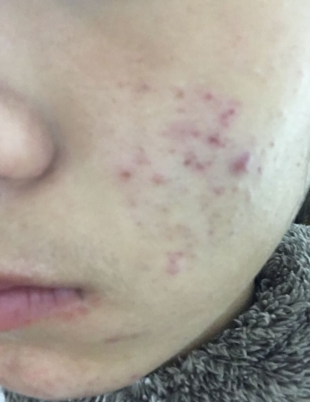 パワーマスク/ラッシュ/洗い流すパック・マスクを使ったクチコミ（3枚目）