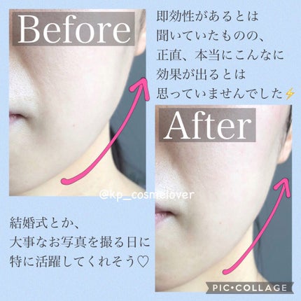 キュエリスト フェイスリフト・エマルジョン/ドゥーシェーン/フェイスクリームを使ったクチコミ(7枚目)