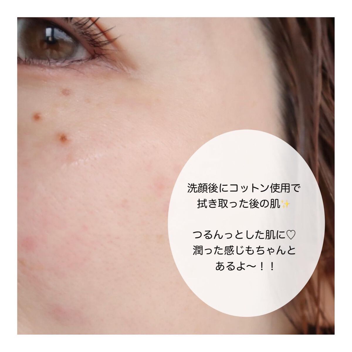 薬用クリア化粧水/メンソレータム アクネス/化粧水を使ったクチコミ(3枚目)