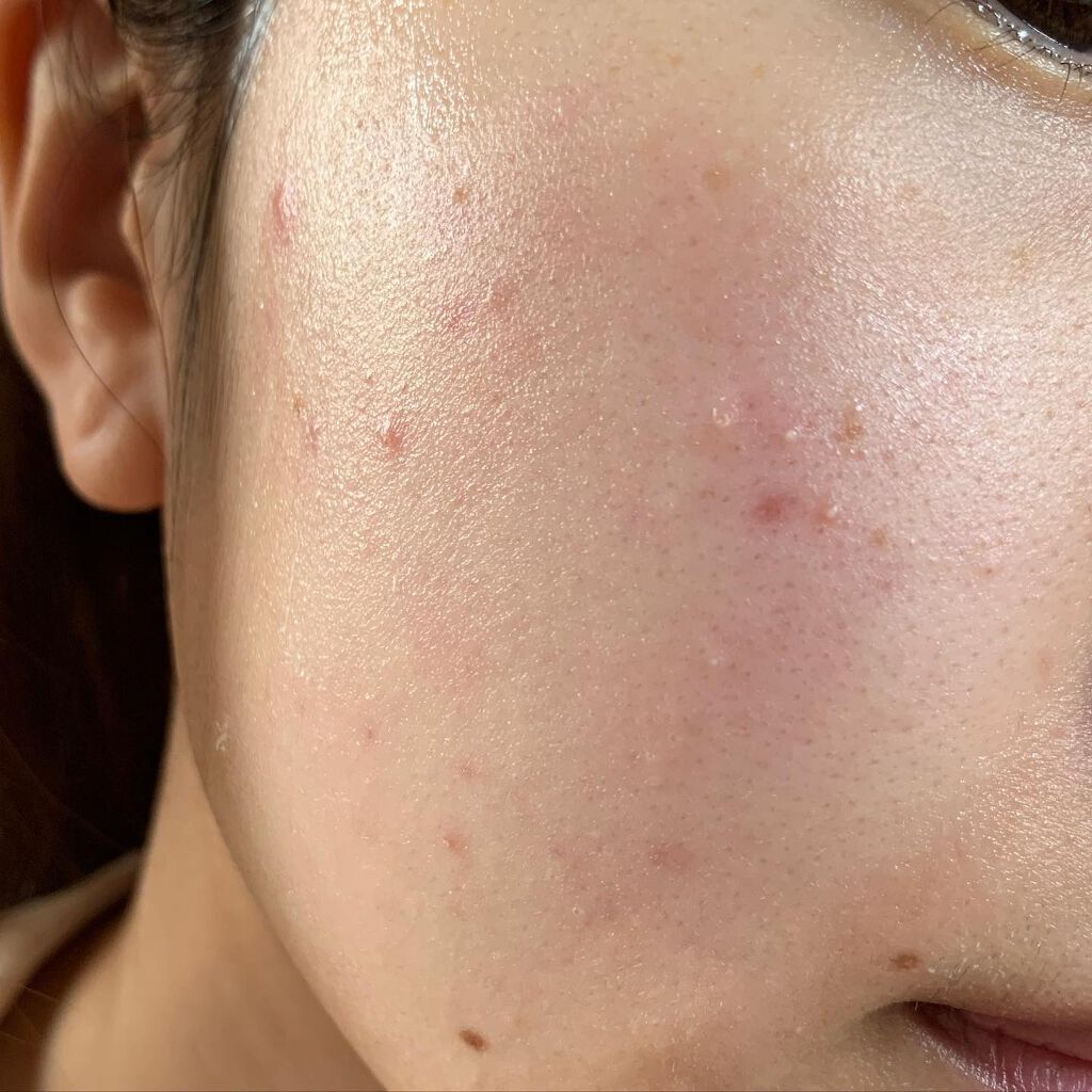 KURO on LIPS 「夏のひやひやパック🧚♂️今お使いのパックで誰でもできます☺️..」(3枚目)