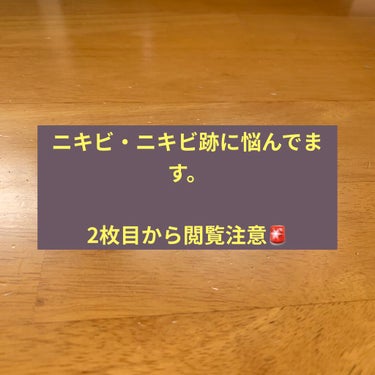 b.glen ホワイトケア トライアルセットのクチコミ「ニキビの経過
ニキビとニキビ跡に悩んでいます。

2枚目が、前回投稿した１1月１８日の写真
3.....」（1枚目）