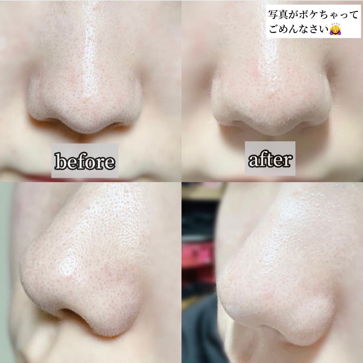 ノーモアブラックヘッド(ノーズピーリング)/One-day's you/スクラブ・ゴマージュを使ったクチコミ(6枚目)