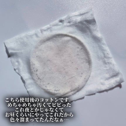 RF温冷美顔器PRO/ANLAN/美顔器・マッサージを使ったクチコミ(5枚目)