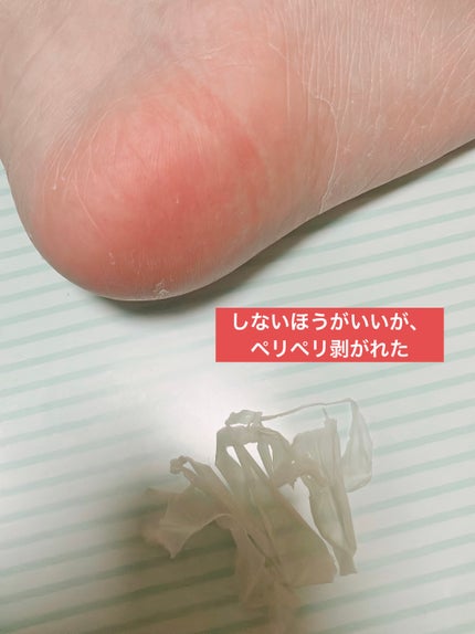 足裏角質ケアパック/and us/その他スキンケアグッズを使ったクチコミ(8枚目)