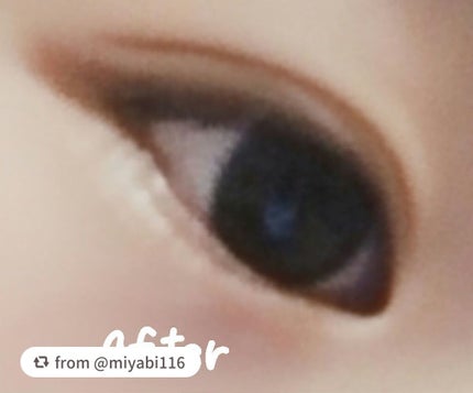 アイトーク スーパーホールド/アイトーク/二重まぶた用アイテムを使ったクチコミ(3枚目)