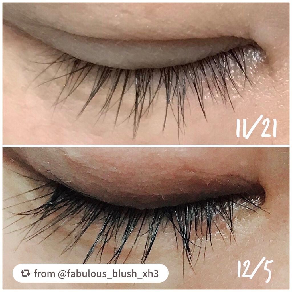 スカルプD ボーテ ピュアフリーアイラッシュセラム プレミアム/アンファー(スカルプD)/まつげ美容液を使ったクチコミ(4枚目)