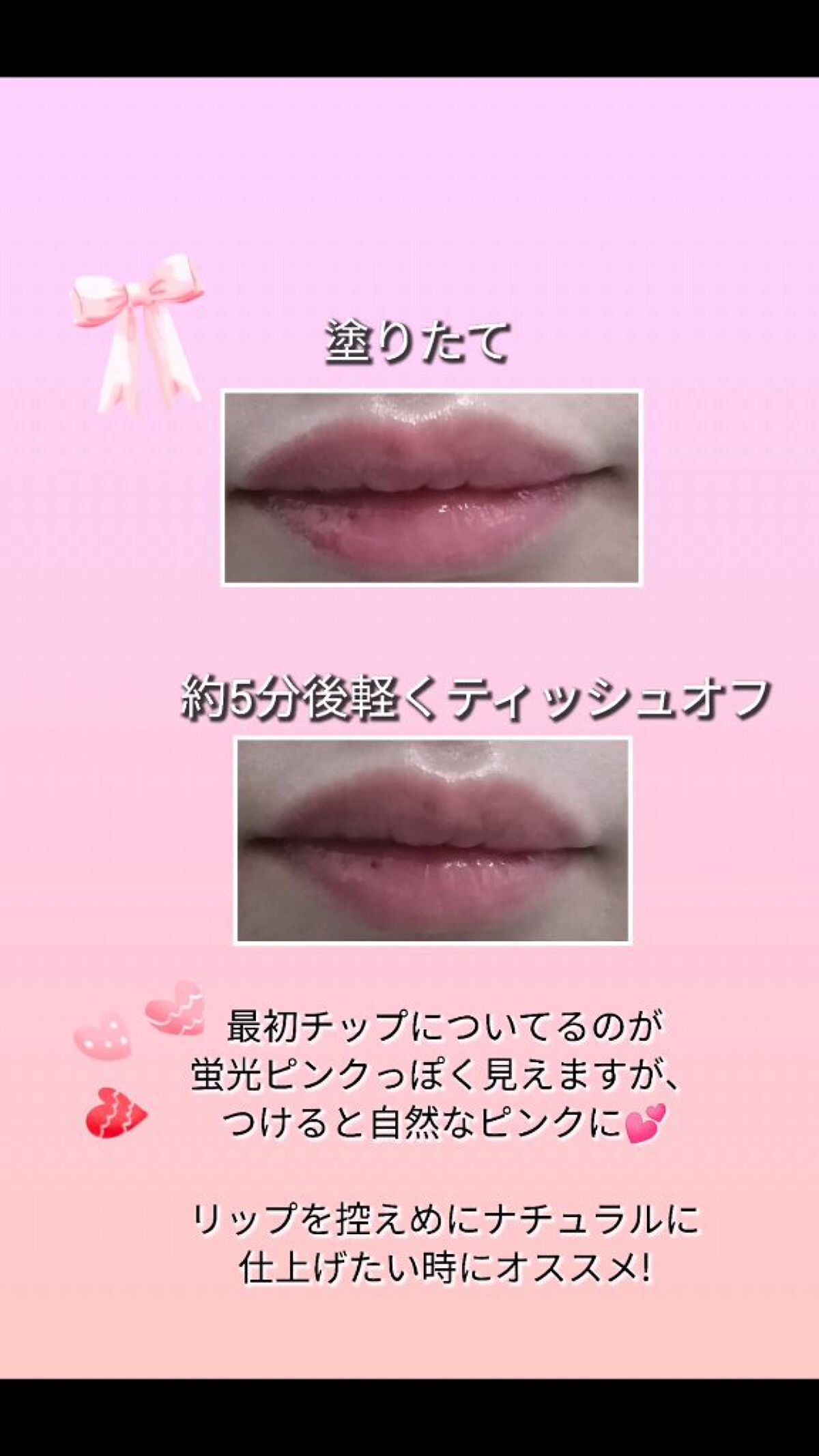 Qoo10/Qoo10/シートマスク・パックを使ったクチコミ(6枚目)