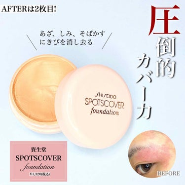 スポッツカバー ファウンデイション/SHISEIDO/クリームコンシーラーを使ったクチコミ（1枚目）