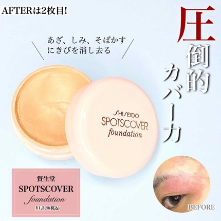 スポッツカバー ファウンデイション/SHISEIDO/クリームコンシーラーを使ったクチコミ(1枚目)