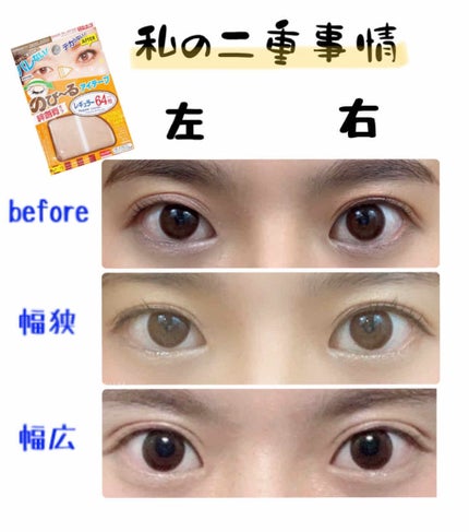 アイテープ(絆創膏タイプ、レギュラー、70枚)/DAISO/二重まぶた用アイテムを使ったクチコミ(1枚目)