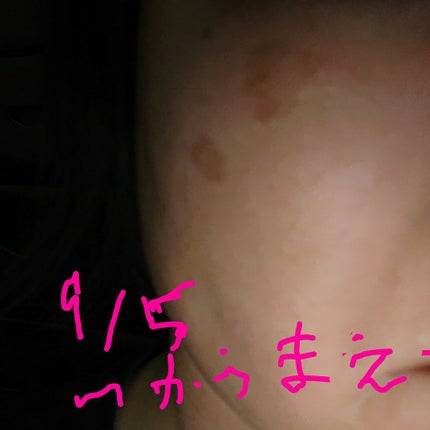 EUKROMA Plus/EUKROMA/その他スキンケアを使ったクチコミ(2枚目)