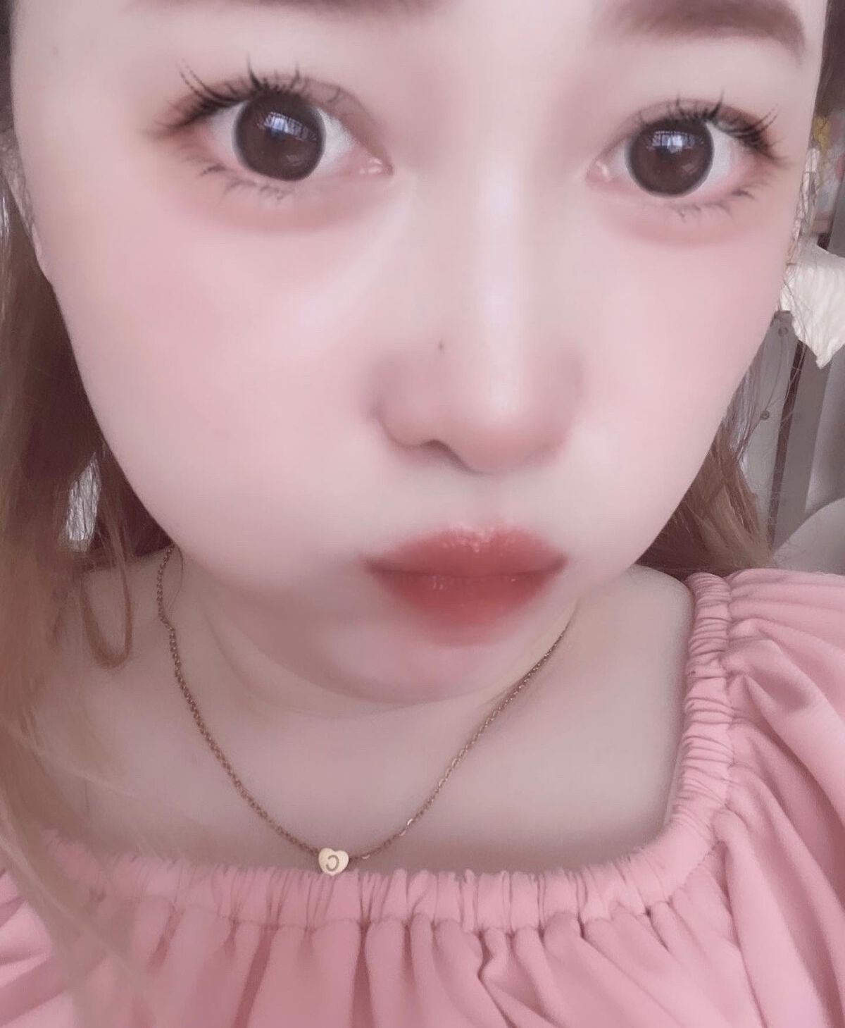 オロナインH軟膏 (医薬品)/オロナイン/その他を使ったクチコミ(7枚目)