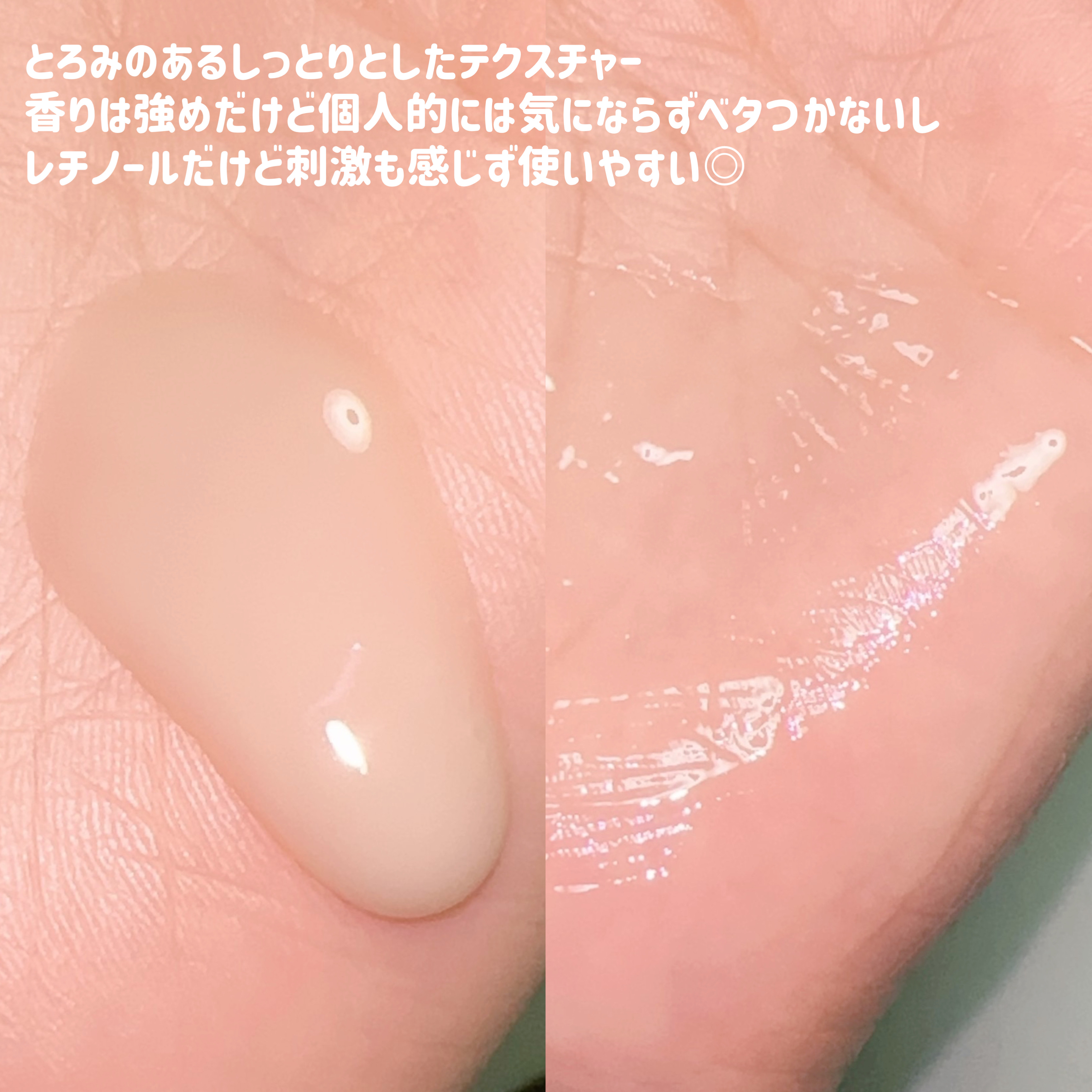 ブラックスネイルレチノールセラム/Dr.G/美容液を使ったクチコミ（3枚目）