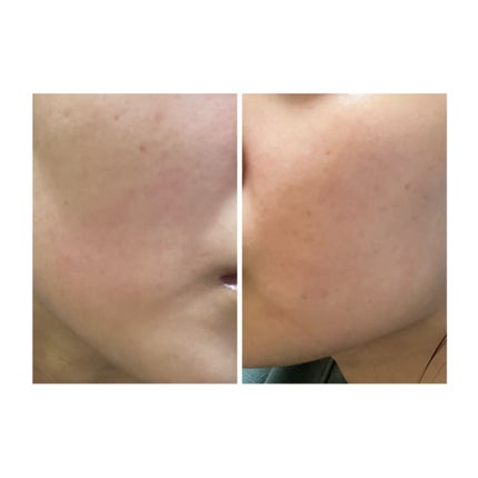 を使ったクチコミ(2枚目)