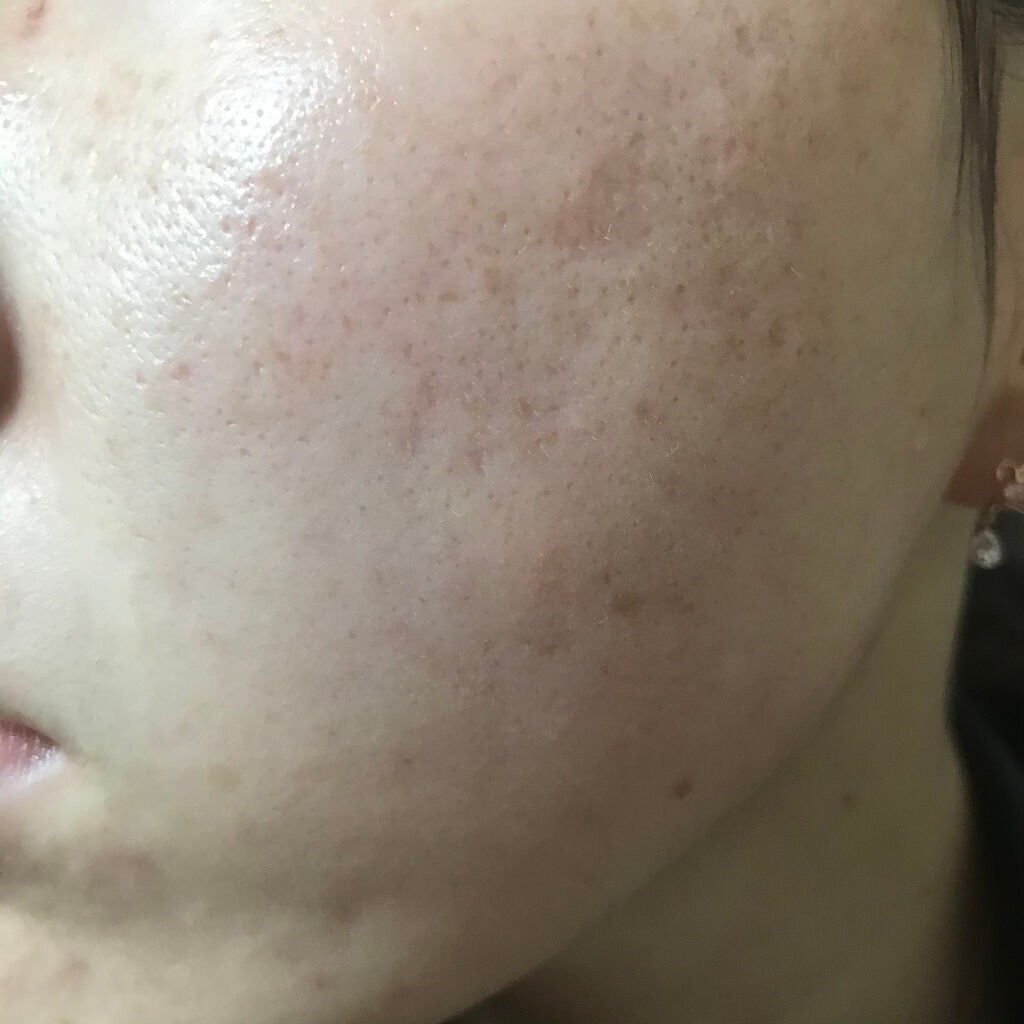 miina@汚肌工事録⚠️ on LIPS 「4/18#汚肌工事録今日の肌、いつもより明るいかも!✨ミルクク..」(2枚目)