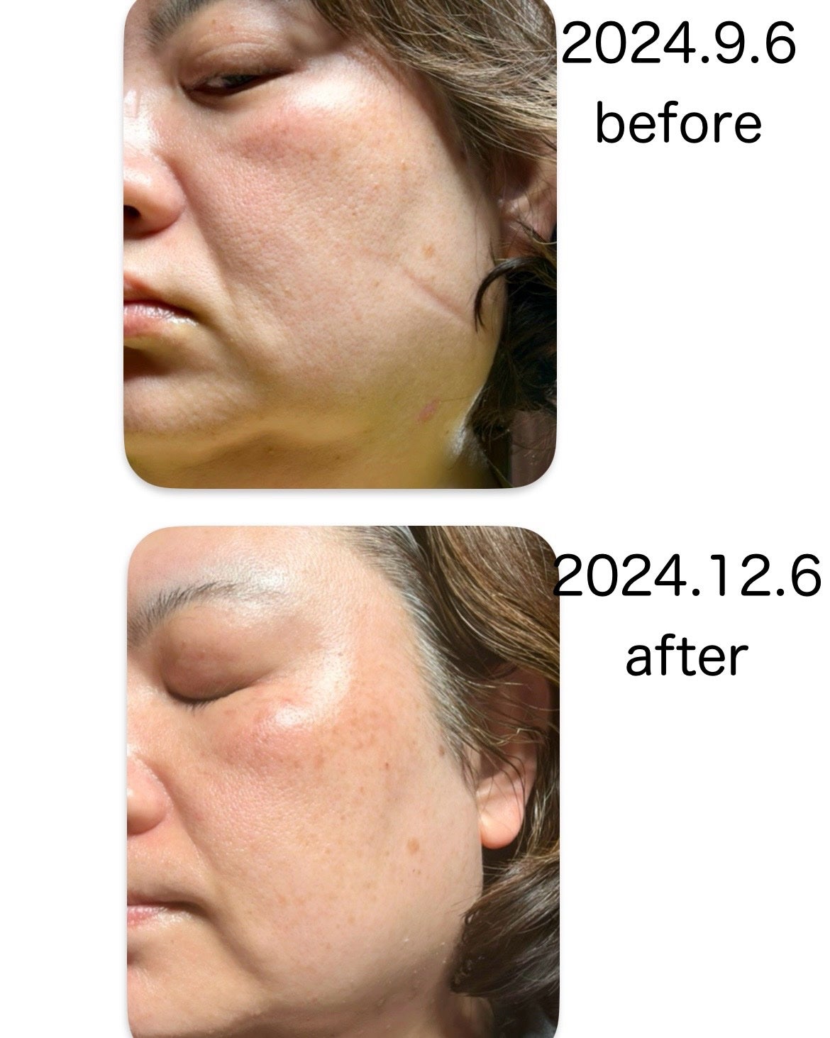 AGE-R ブースタープロ/MEDICUBE/美顔器・マッサージを使ったクチコミ(3枚目)