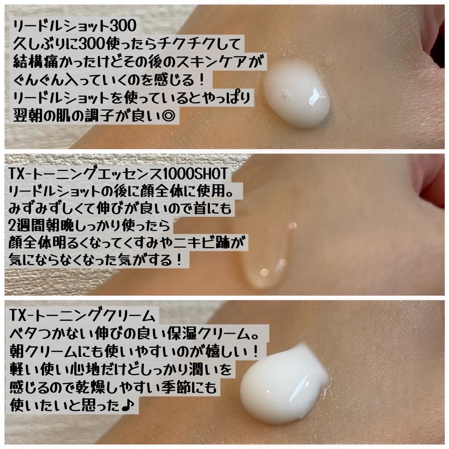 リードルショット300/VT/美容液を使ったクチコミ（3枚目）