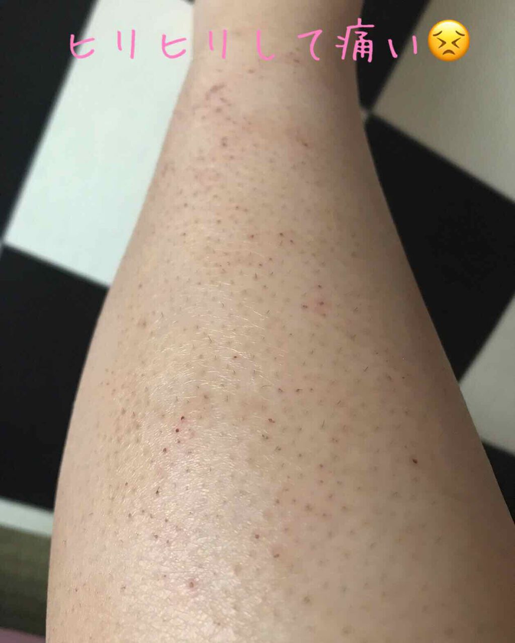 脱色クリーム 敏感肌用/エピラット/ムダ毛ケアを使ったクチコミ(2枚目)