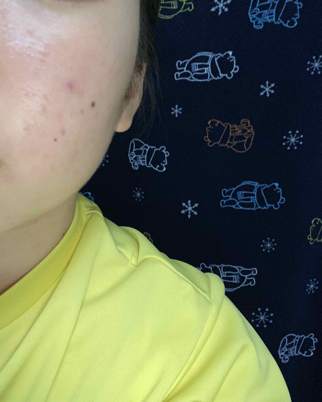 明色美顔水 薬用化粧水/美顔/化粧水を使ったクチコミ(2枚目)