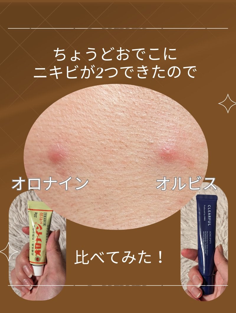 オロナインH軟膏 (医薬品)/オロナイン/その他を使ったクチコミ(4枚目)