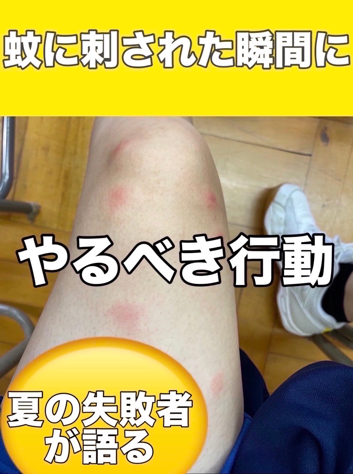 アットノンEX クリーム(医薬品)/アットノン/その他を使ったクチコミ(1枚目)