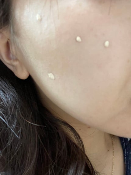 タトゥーウォータープルーフスカーコンシーラー/フォレンコス/リキッドコンシーラーを使ったクチコミ(5枚目)