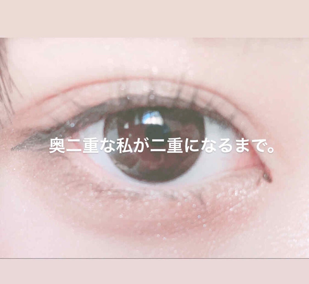 のびーるアイテープ(絆創膏タイプ、レギュラー)/DAISO/二重まぶた用アイテムを使ったクチコミ(1枚目)