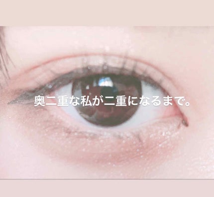 のびーるアイテープ(絆創膏タイプ、レギュラー)/DAISO/二重まぶた用アイテムを使ったクチコミ(1枚目)