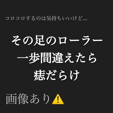 
足痩せに使うローラー(？)の使い過ぎには気をつけてください！！

もも裏などコロコロすると気持ちいいですよね

私の持っているものは、画像のようにボコボコしている丸太の形のものです！

浮腫も取れる感