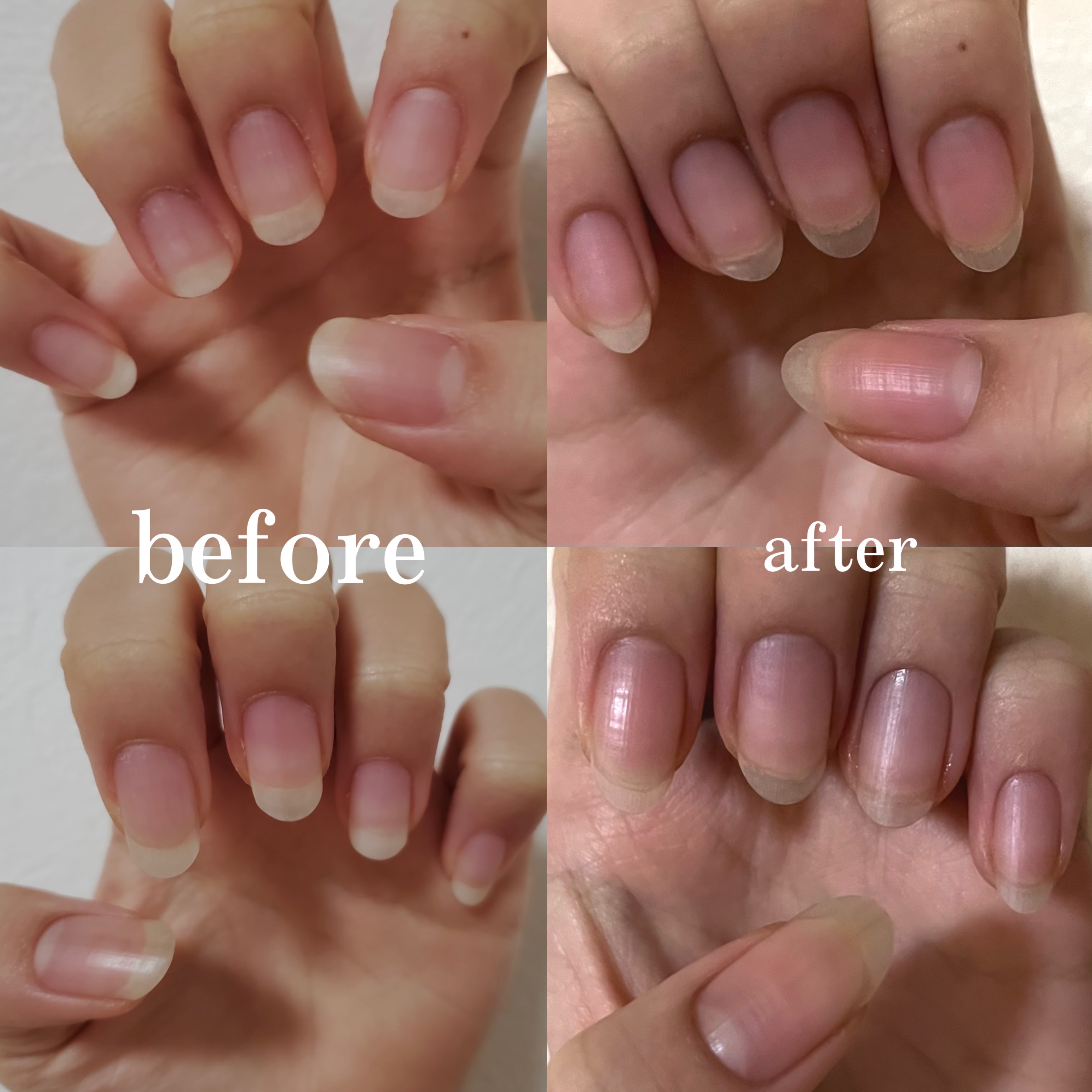 Mimits モイストネイルオイル Mimits モイストネイルオイル　レモン/ビー・エヌ/ネイルオイル・トリートメントを使ったクチコミ（2枚目）