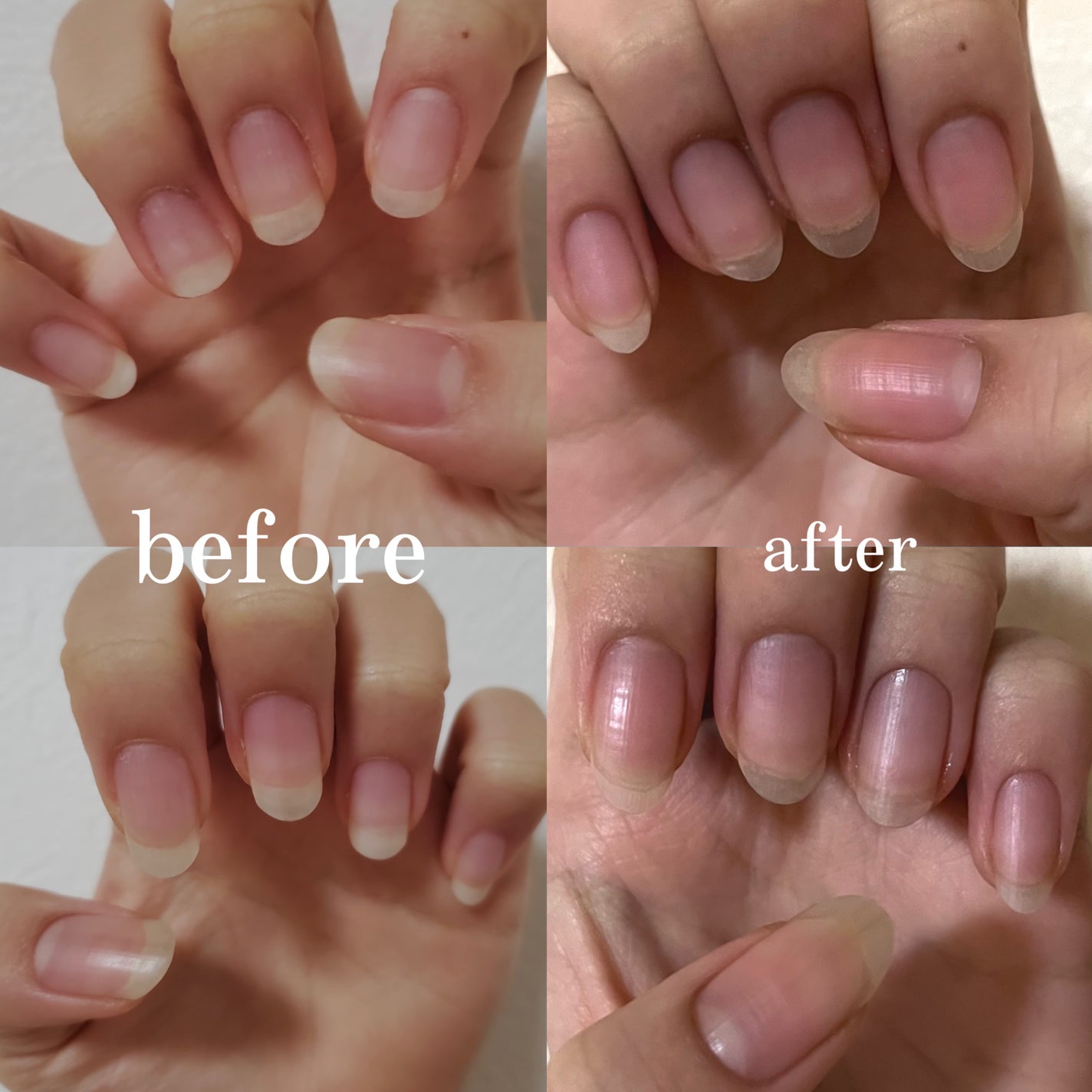 しずくネイルオイル/キャンドゥ/ネイルオイル・トリートメントを使ったクチコミ(2枚目)