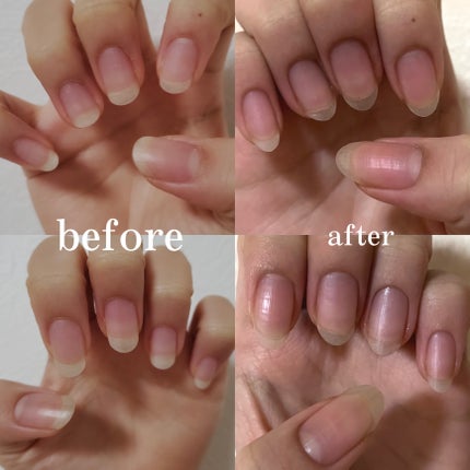 しずくネイルオイル/キャンドゥ/ネイルオイル・トリートメントを使ったクチコミ(2枚目)