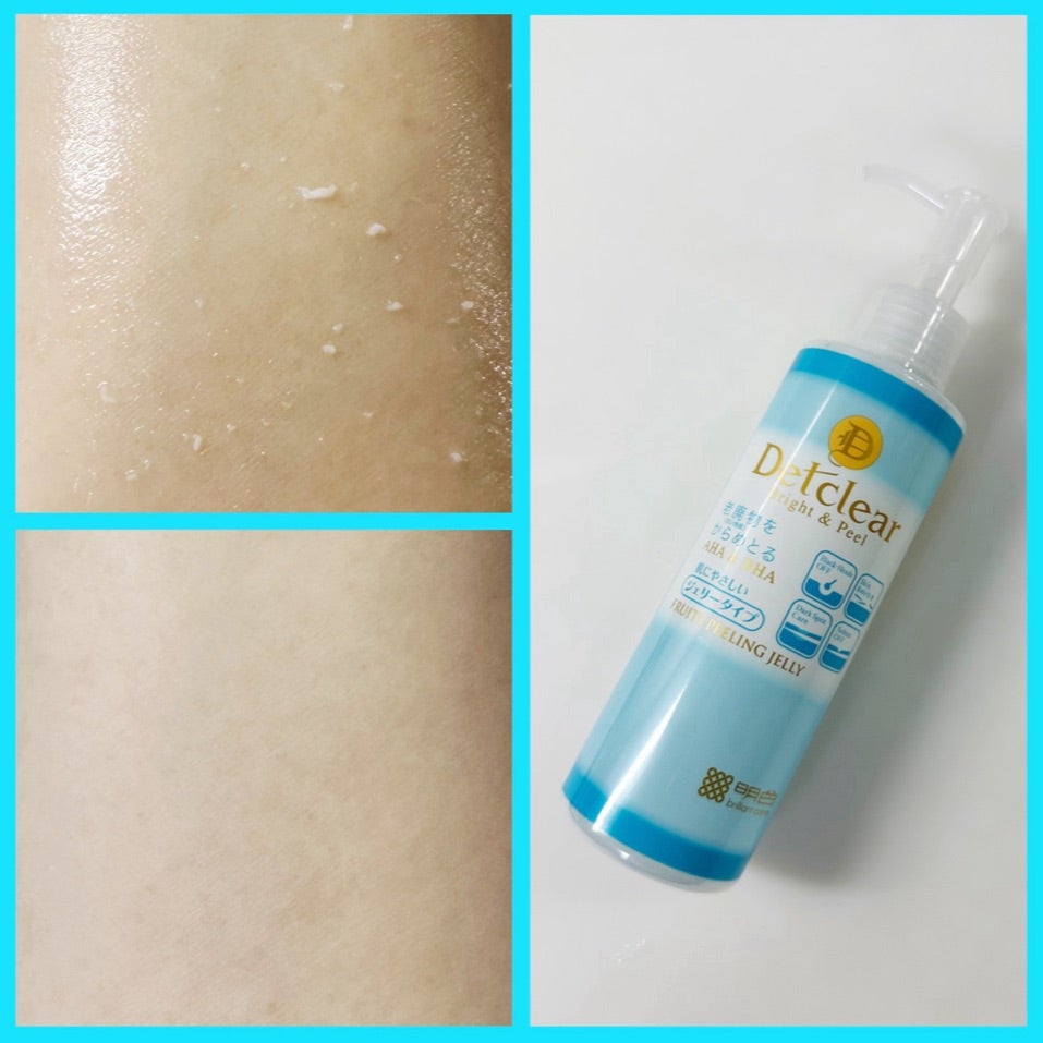 DETクリア ブライト&ピール ピーリングジェリー<無香料タイプ>/Detclear/ピーリングを使ったクチコミ(3枚目)