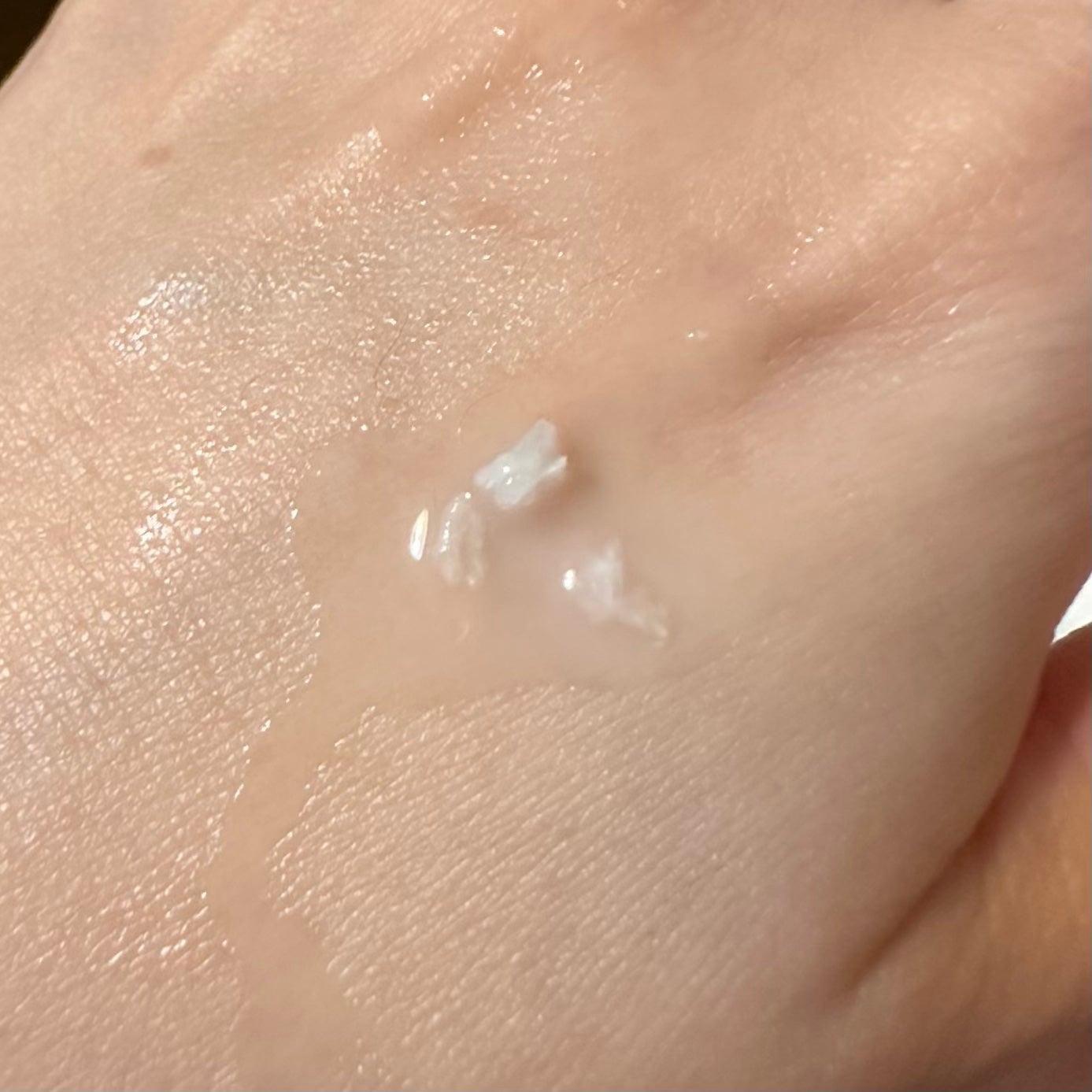 ダーマセラム アゼライン酸5%/SHIMBI METHOD/美容液を使ったクチコミ(1枚目)