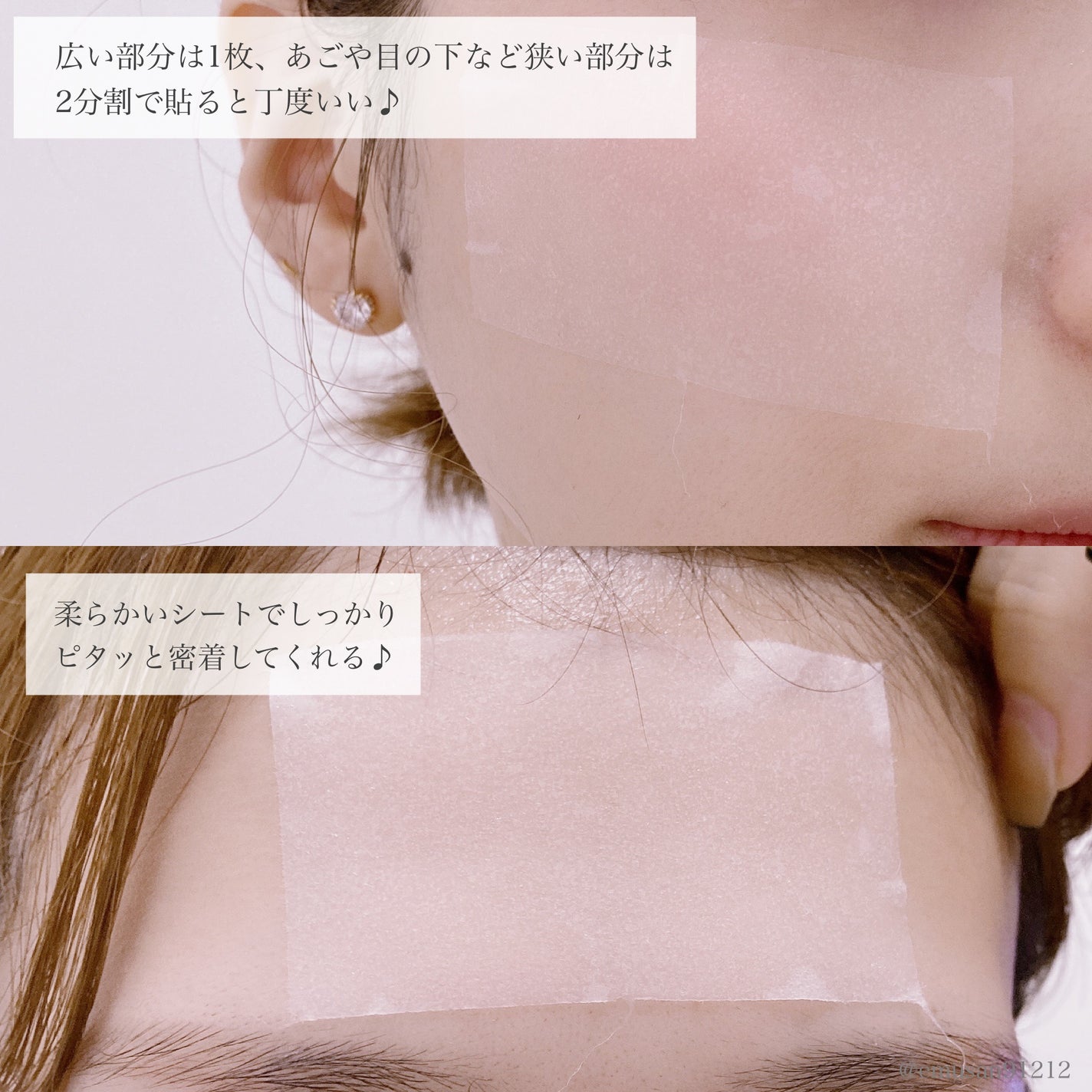 プロバイオダームタイトニングT3コラーゲンパッド/BIOHEAL BOH/トナーパッドを使ったクチコミ(7枚目)