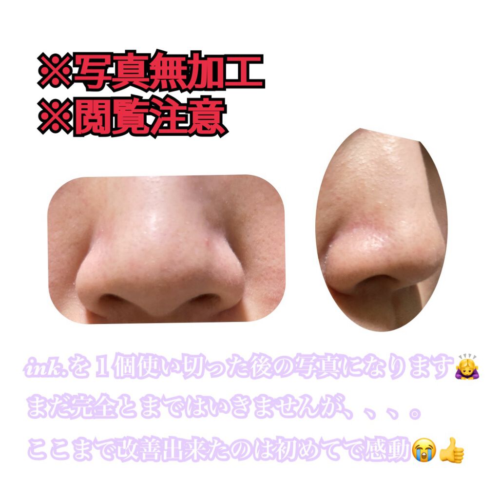 小鼻すっきり炭パック/DAISO/その他スキンケアを使ったクチコミ（3枚目）