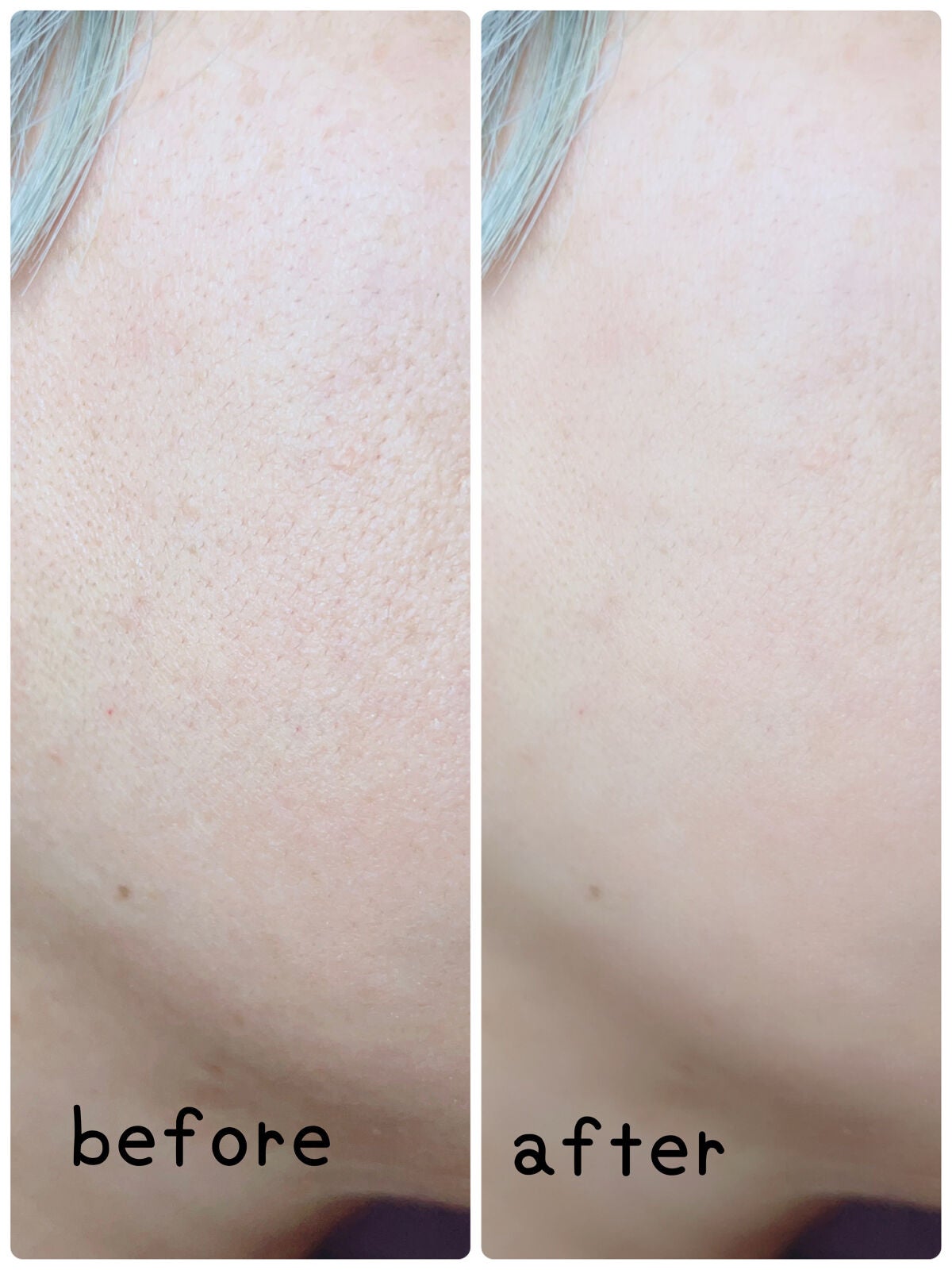 ムーンプレストブライトパウダー/KATE/プレストパウダーを使ったクチコミ(5枚目)