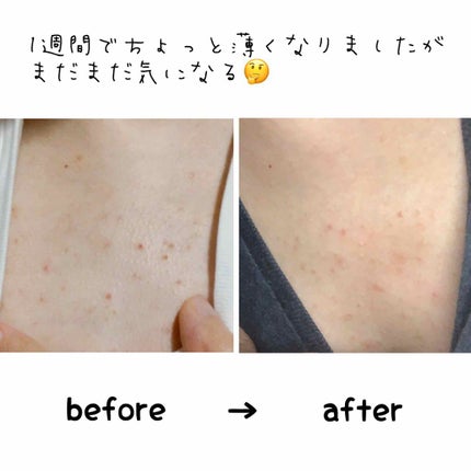 豆乳イソフラボン配合全身化粧水/しっとり工房/ボディローションを使ったクチコミ(2枚目)