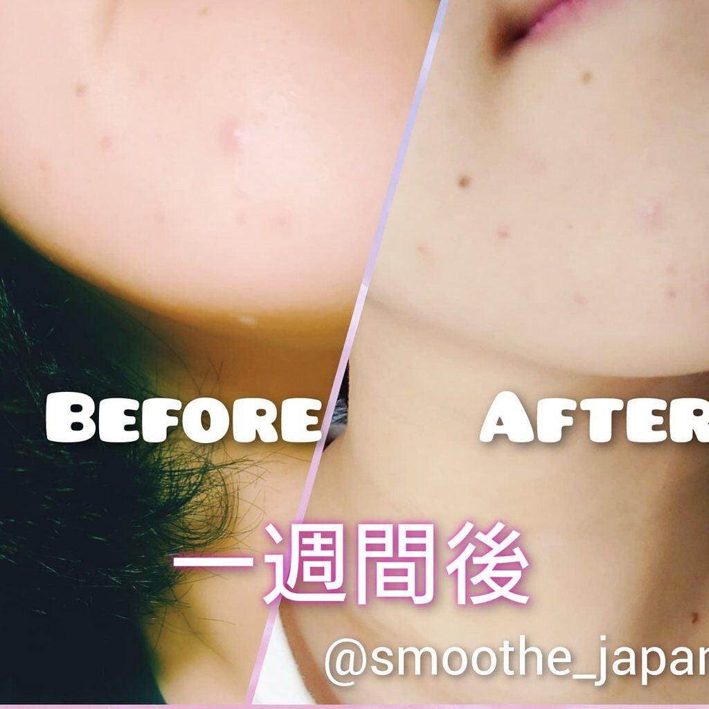 スムースEクリーム/SMOOTH E/フェイスクリームを使ったクチコミ(2枚目)