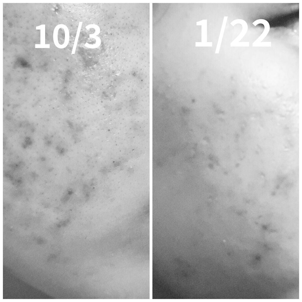 ロゼット洗顔パスタ 海泥スムース/ロゼット/洗顔フォームを使ったクチコミ(1枚目)