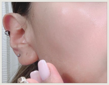 コンセントレーションW/RAIZ repair/美容液を使ったクチコミ(3枚目)