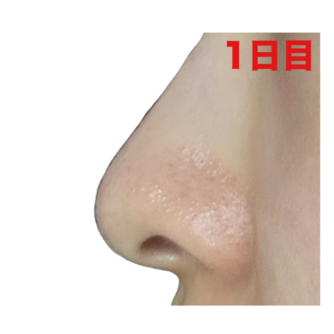 薬用 しみ 集中対策 美容液/メラノCC/美容液を使ったクチコミ(4枚目)