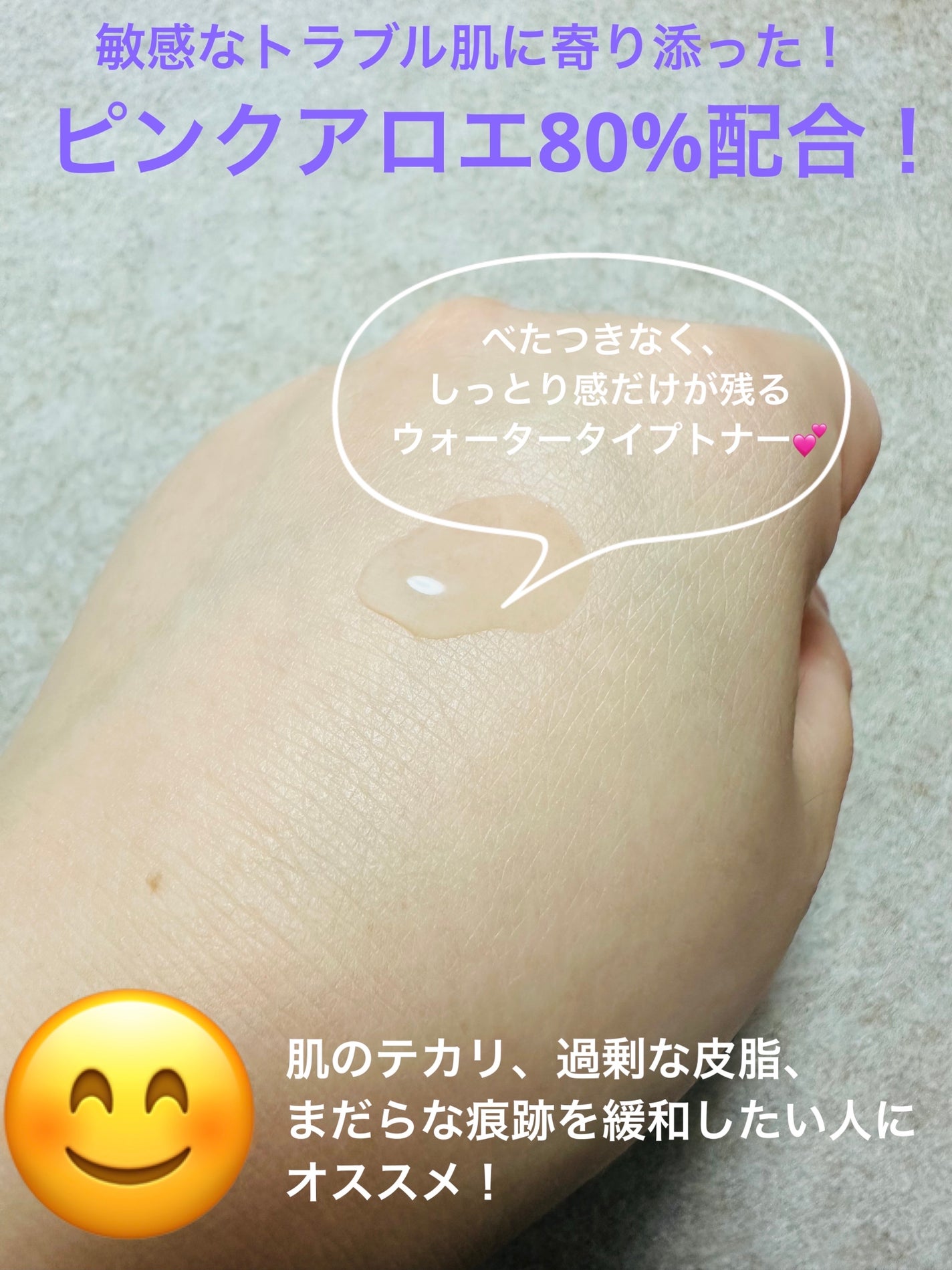 ピンクアロエビタトナー/APRILSKIN/化粧水を使ったクチコミ(4枚目)